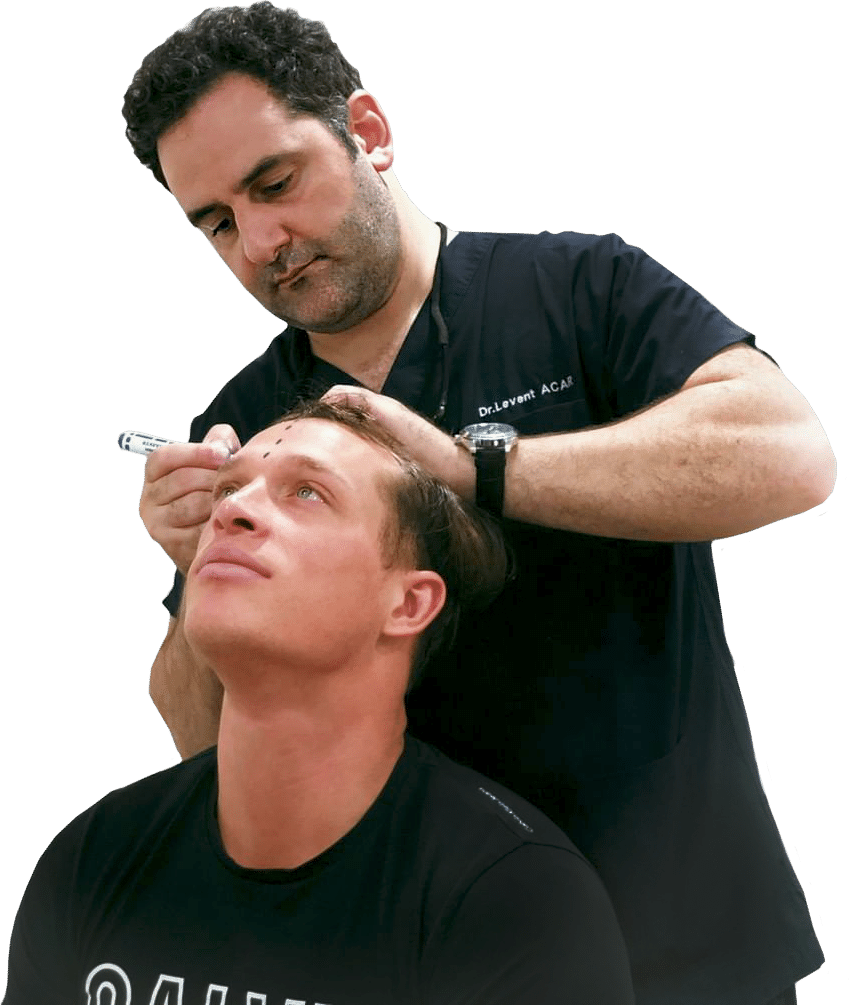 dr acar setting the hair line