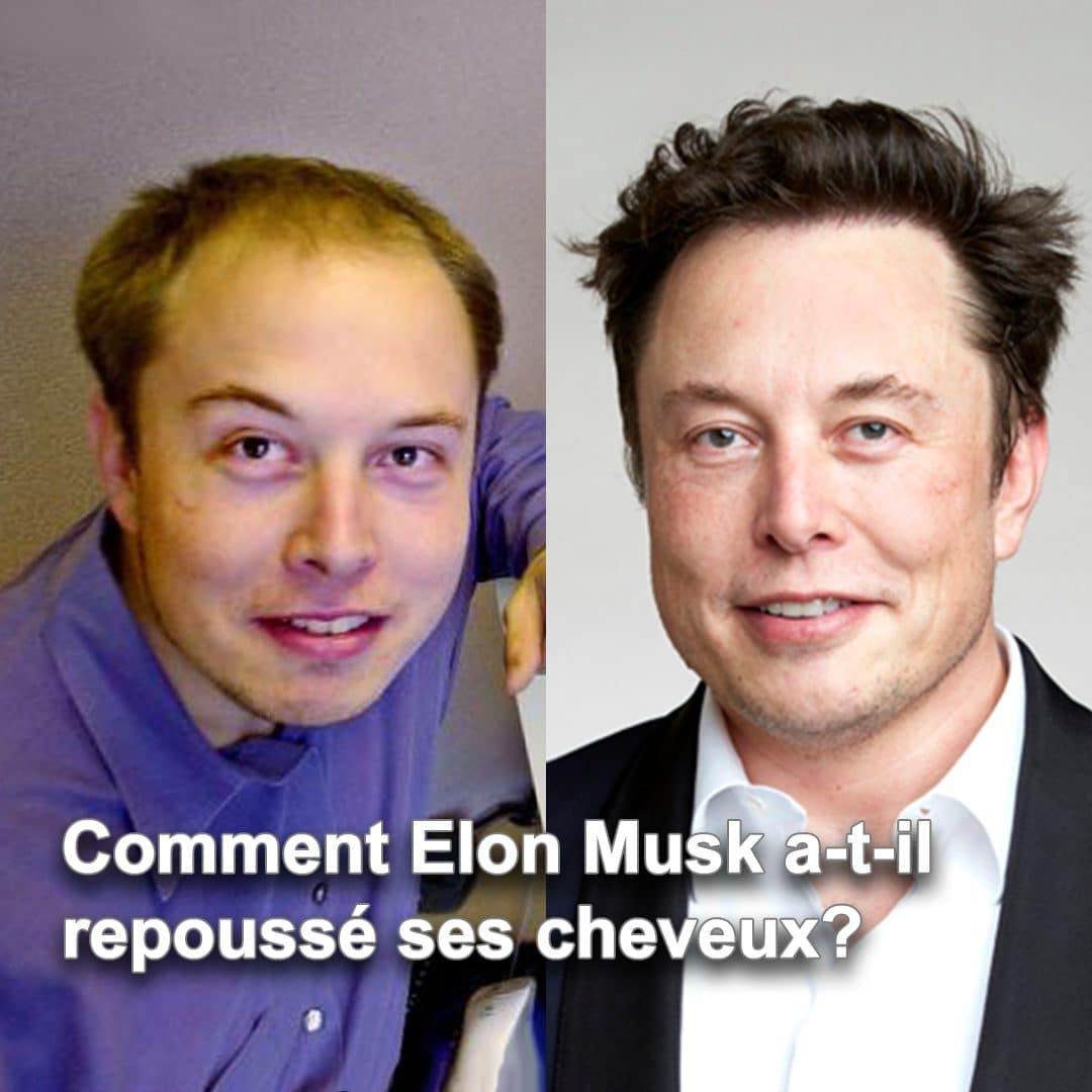 Elon Musk cheveux