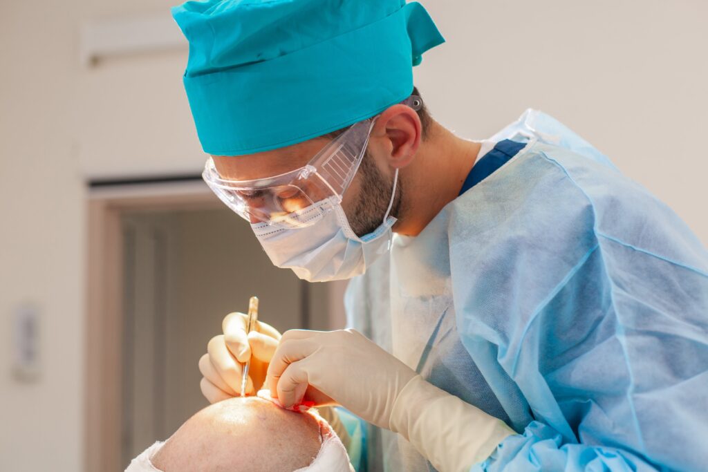 Surgeon in the operating room carrying out hair transplant surgery.