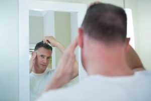 scalp fungus hair loss