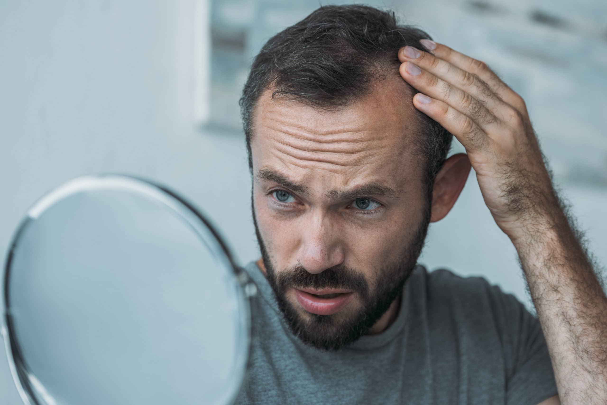 How to fix bad hair transplant