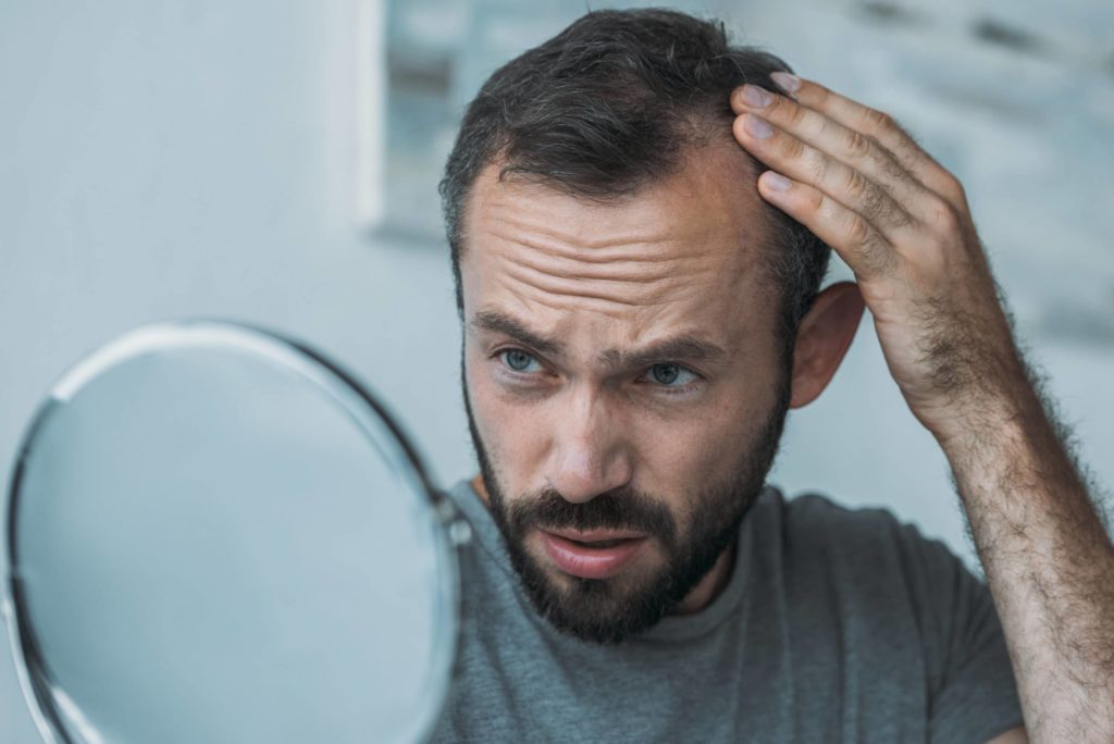 Jak naprawić zły przeszczep włosów?