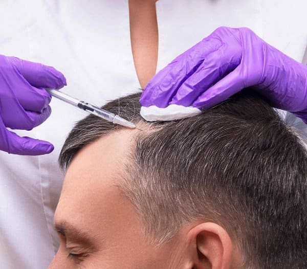 пересадка волос в Турции, включая терапию против выпадения волос