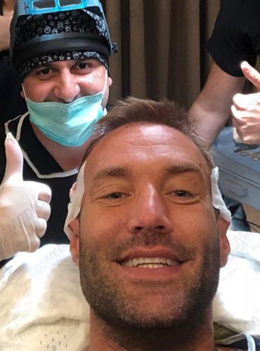 Calum Best during his hair transplant with Dr. Acar giving the thumbs up in the background