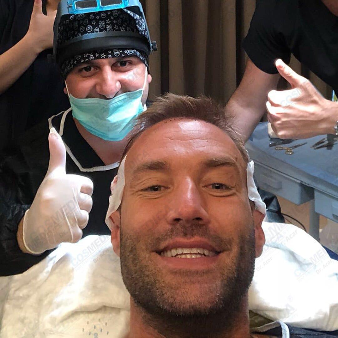 Calum Best during his hair transplant with Dr. Acar giving the thumbs up in the background