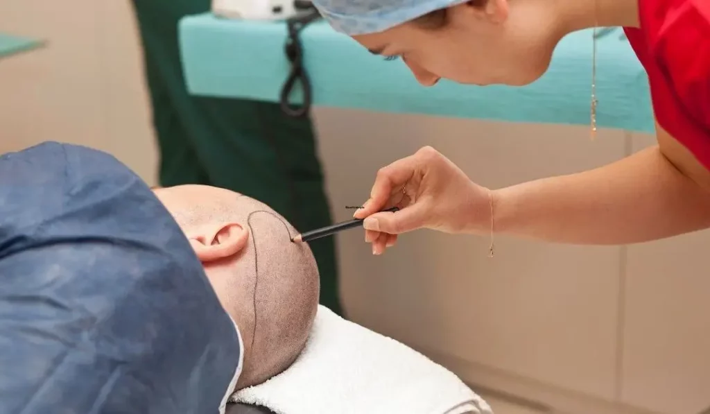 Medical tourism hair transplant in Turkey