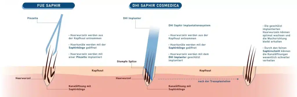 DHI-Saphir