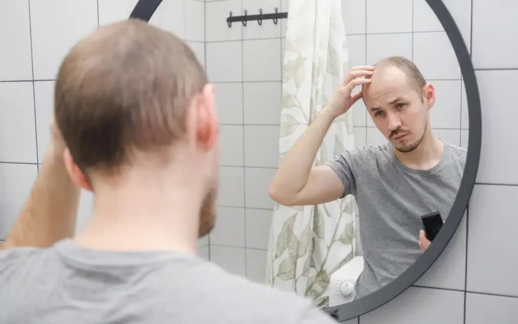 Мужчина с выпадением волос стоит перед зеркалом