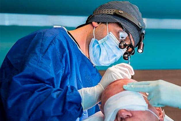 Lekarz otwiera kanały na skórze głowy