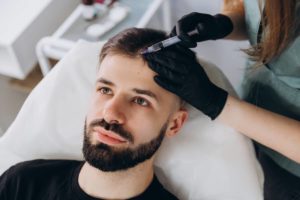 Mężczyzna otrzymujący zastrzyk do mezoterapii na wypadanie włosów