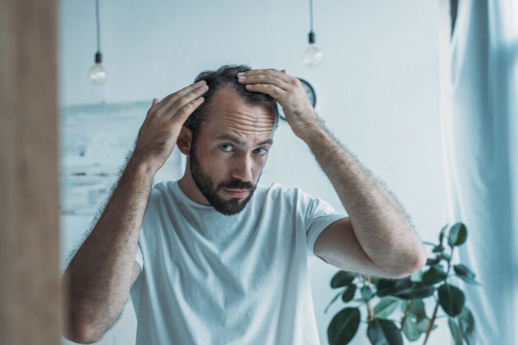 Homme examinant sa perte de cheveux liée au stress