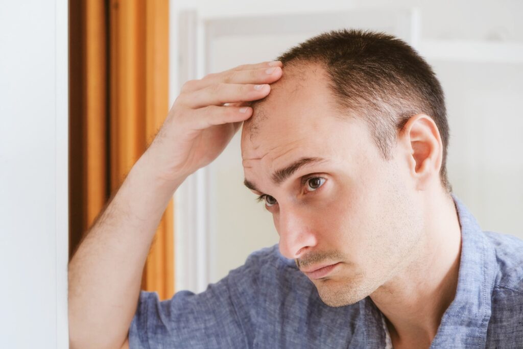 Homme stressé par sa perte de cheveux