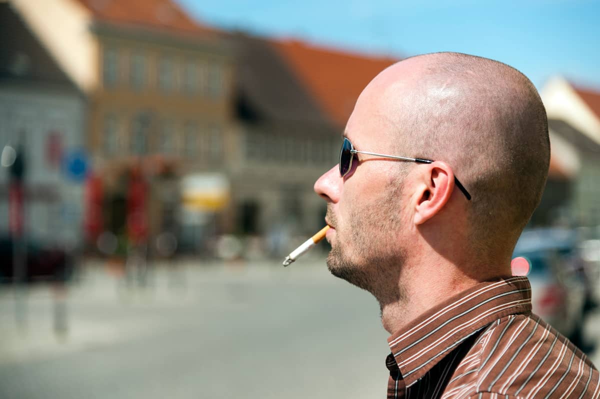 Man with cigarette and bald head wondering "does smoking cause hair loss?"