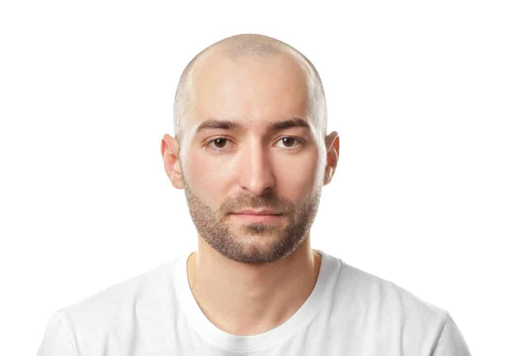 Young bald man