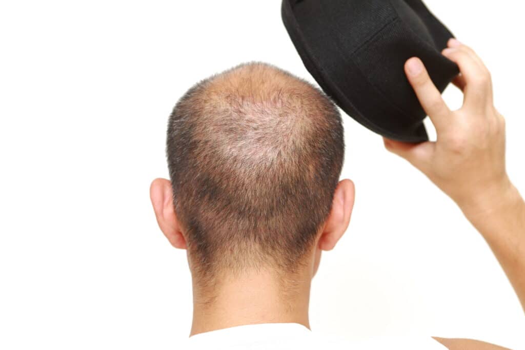 Uomo che sta per indossare un cappello fotografato da dietro