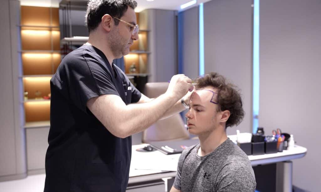 Il Dr. Acar disegna la linea dei capelli ad un paziente