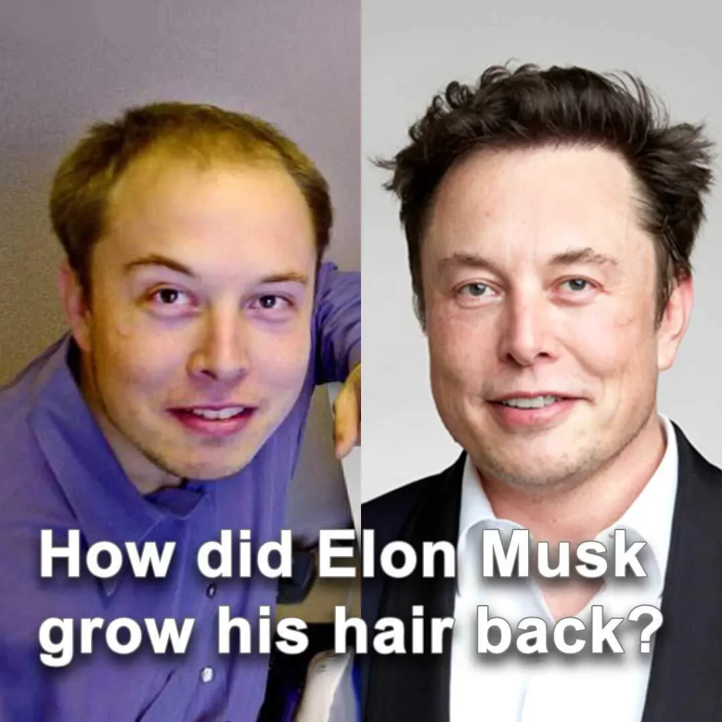 A before and after comparison of Elon Musk's hair in the early 200s and today