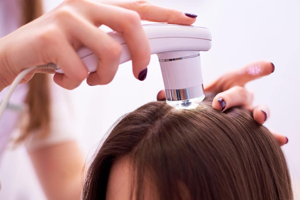 Esame microscopico dei capelli e della cute del cuoio capelluto di una donna