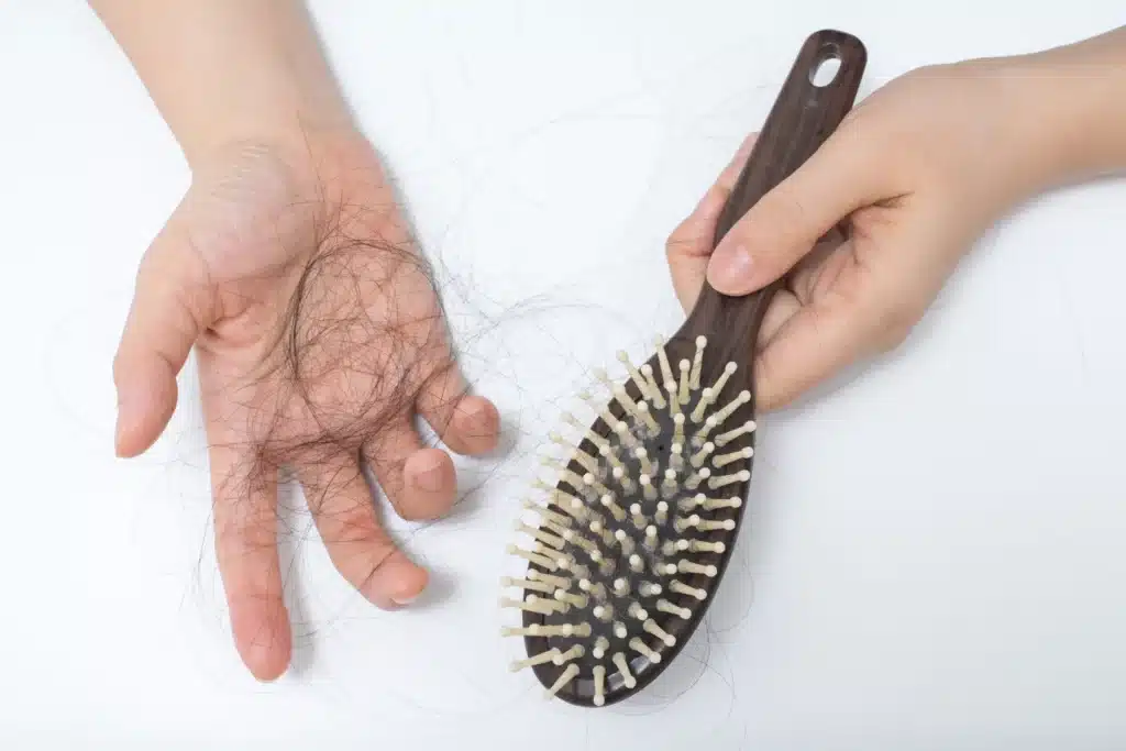 Haarausfall-nach-der-Haartransplantation_Shedding