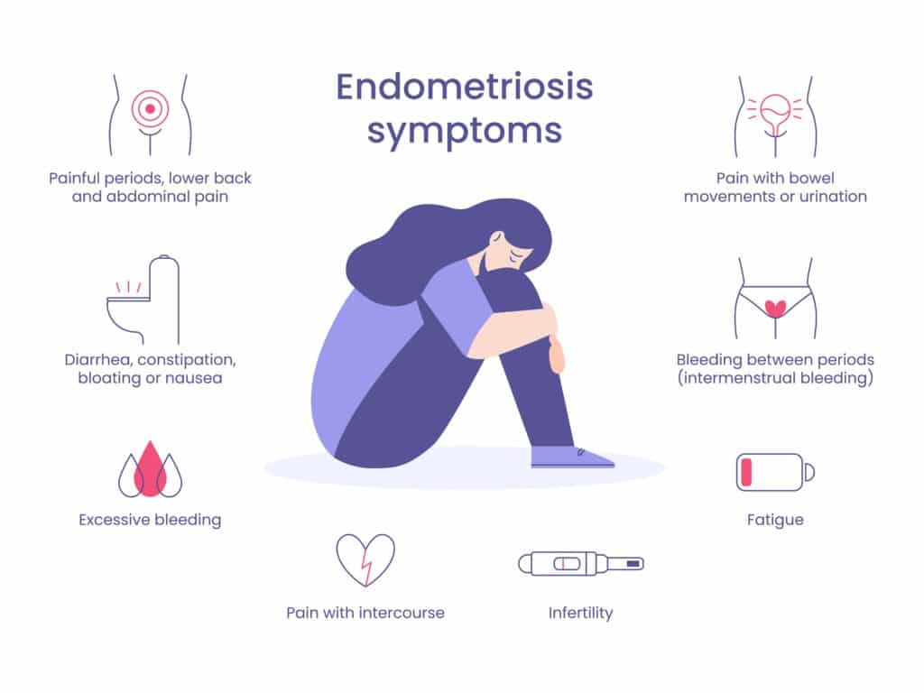 Hair Loss is not one of the main symptoms of endometriosis