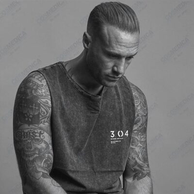 Calum Best Haartransplantation Ergebnis