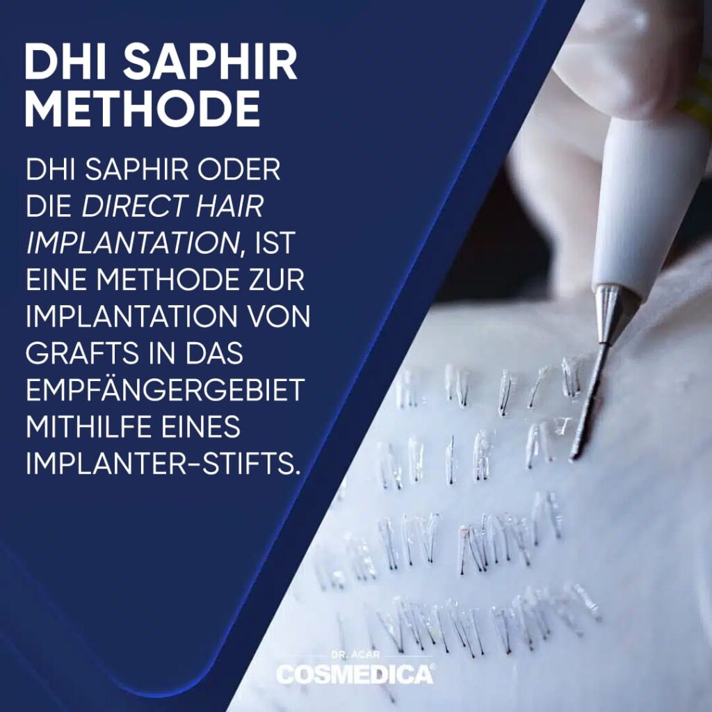 DHI-Saphir-Methode