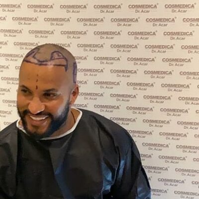 Ricky Whittle neuer Haaransatz