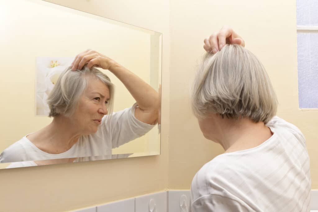 Donna anziana preoccupata che esamina la perdita di capelli allo specchio.