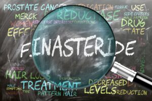 Finasteride can be used after a hair transplant