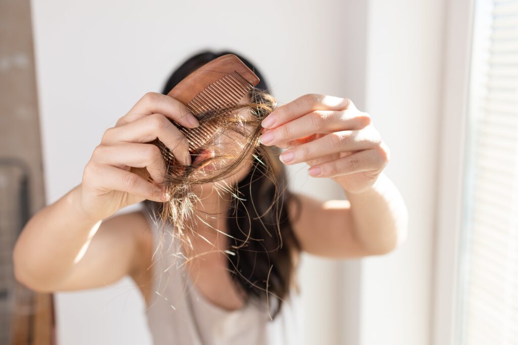 queda de cabelo por stress o que fazer