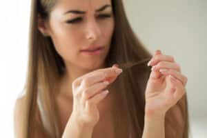 Una donna soffre di perdita di capelli