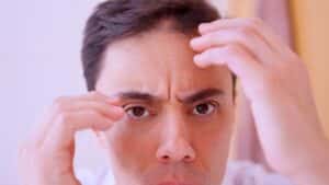 Hombre preocupado comprobando la caída del cabello y tocándose la frente