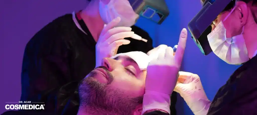 Trasplante capilar en curso