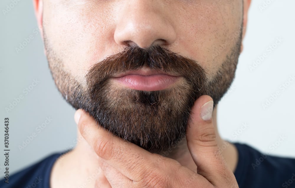 Die Barthaartransplantation im Überblick