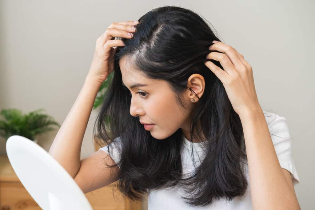 Haare zurückgewinnen: Diese Methoden sind am effektivsten