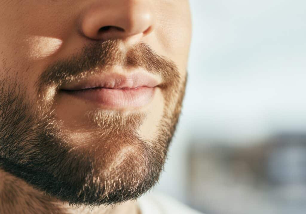 Lücken schließen mit einer Barthaartransplantation