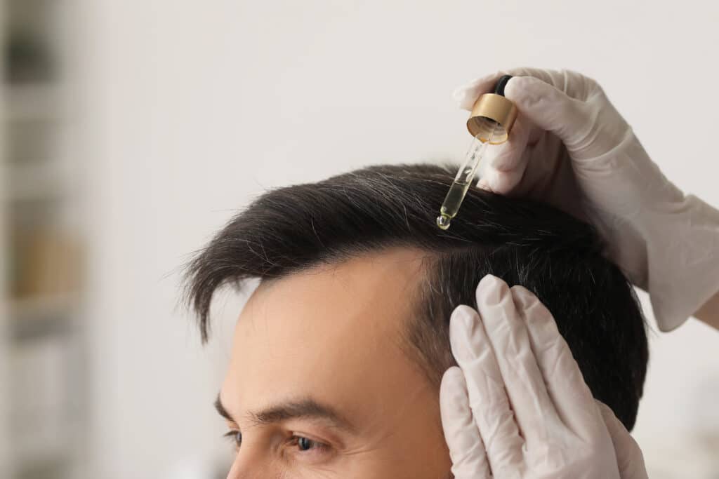 Médico aplicando suero en el cabello de un hombre en una clínica