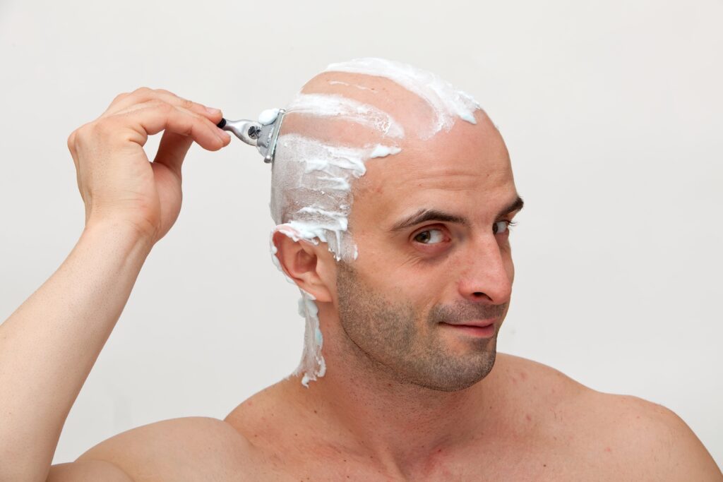 Why Do Hair Transplants Fail 7 Facts You Must Know why-do-hair-transplants-fail-7-facts-you-must-know