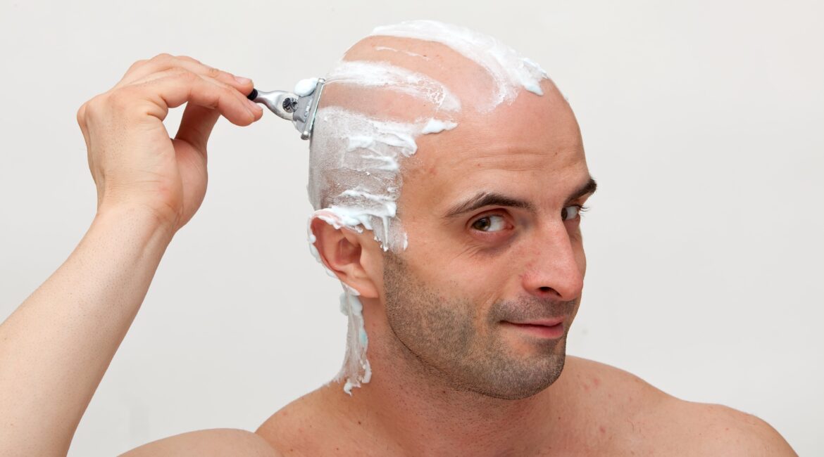 Man sheves his head before a hair transplant