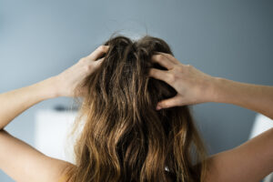 Donna con prurito in testa si gratta i capelli