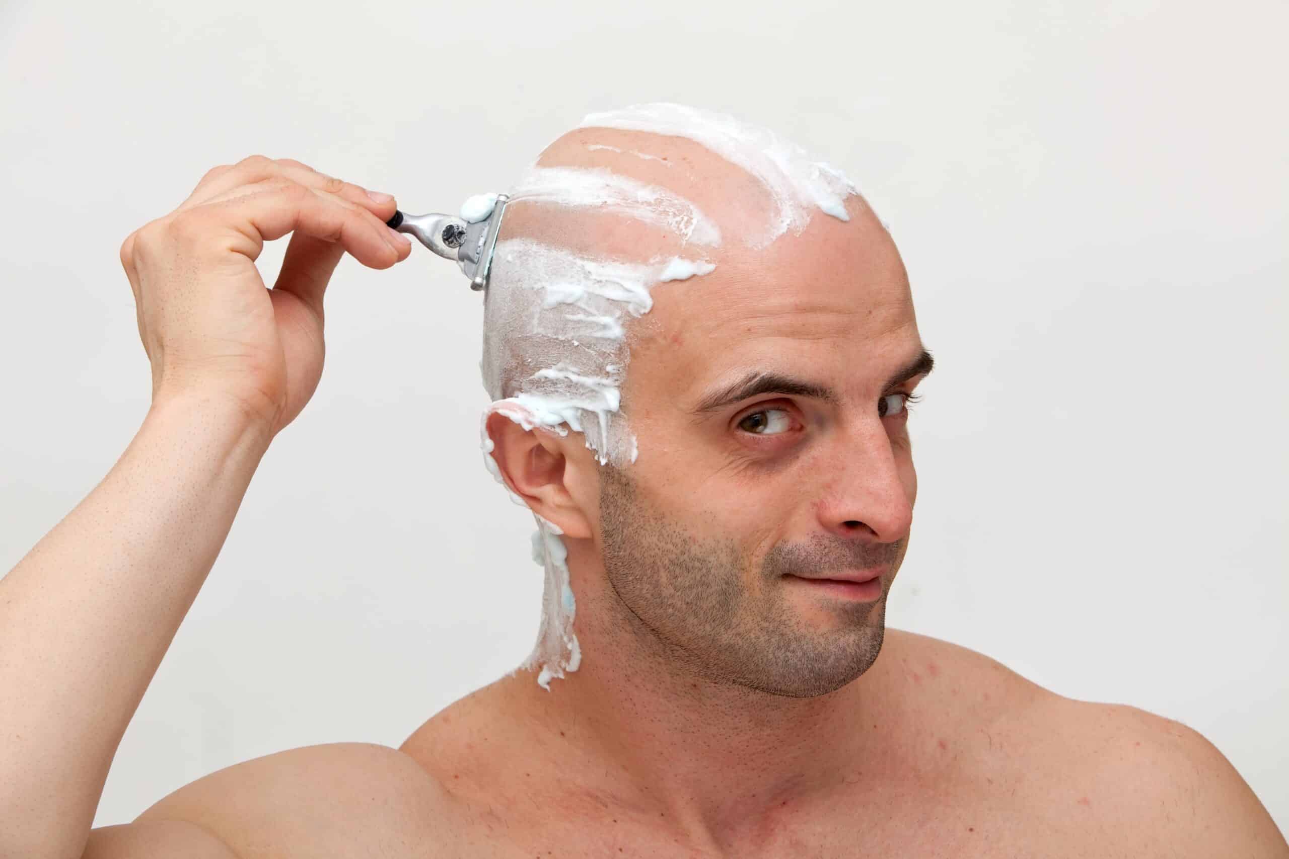haartransplantatie zonder scheren