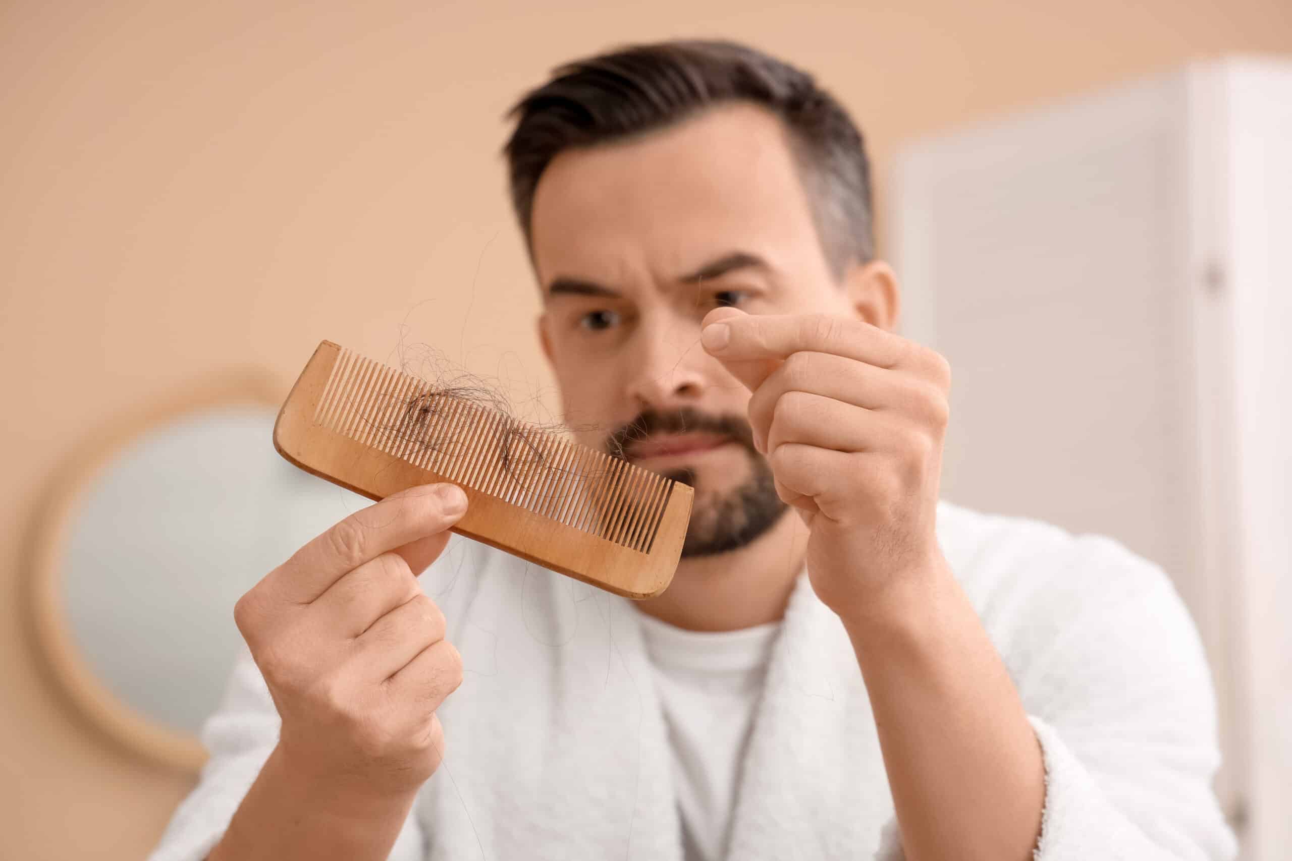 Un hombre con problemas de caída del cabello piensa en el trasplante capilar a los 50 años