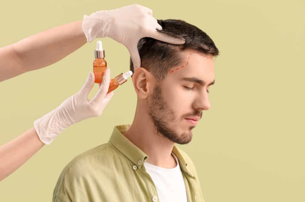 Médico con frascos de suero para el crecimiento del cabello con paciente
