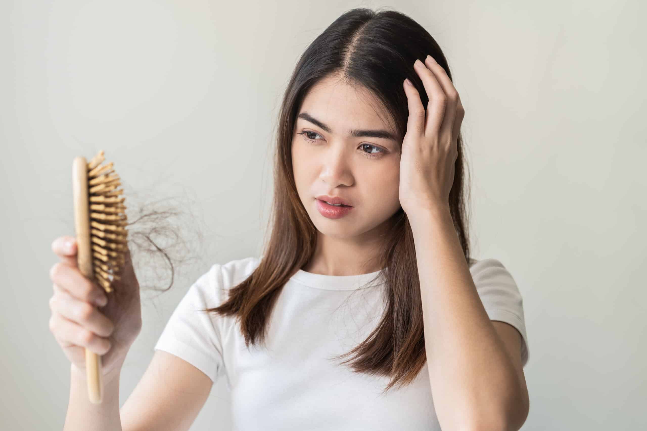 Una mujer que sufre alopecia femenina se mira el pelo perdido después de peinarse