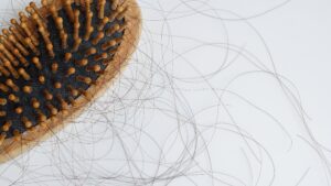 quantidade normal de queda de cabelo