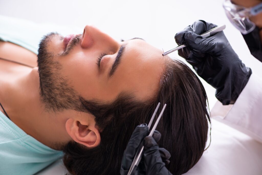Unshaven hair transplant procedure