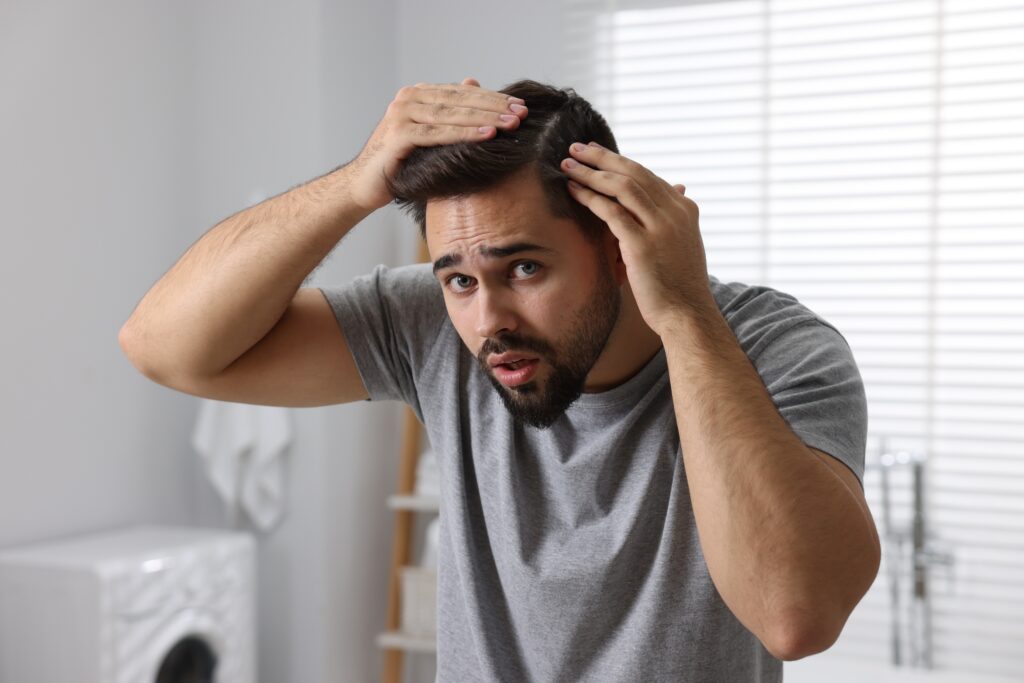 Uomo con forfora e prurito ai capelli si controlla allo specchio