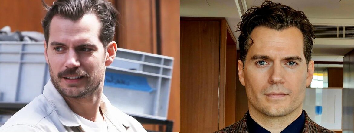 Henry Cavill before and after hair transplant comparison