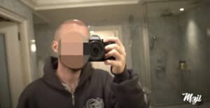 Mojis Gesicht: sein weg zur Haartransplantation
