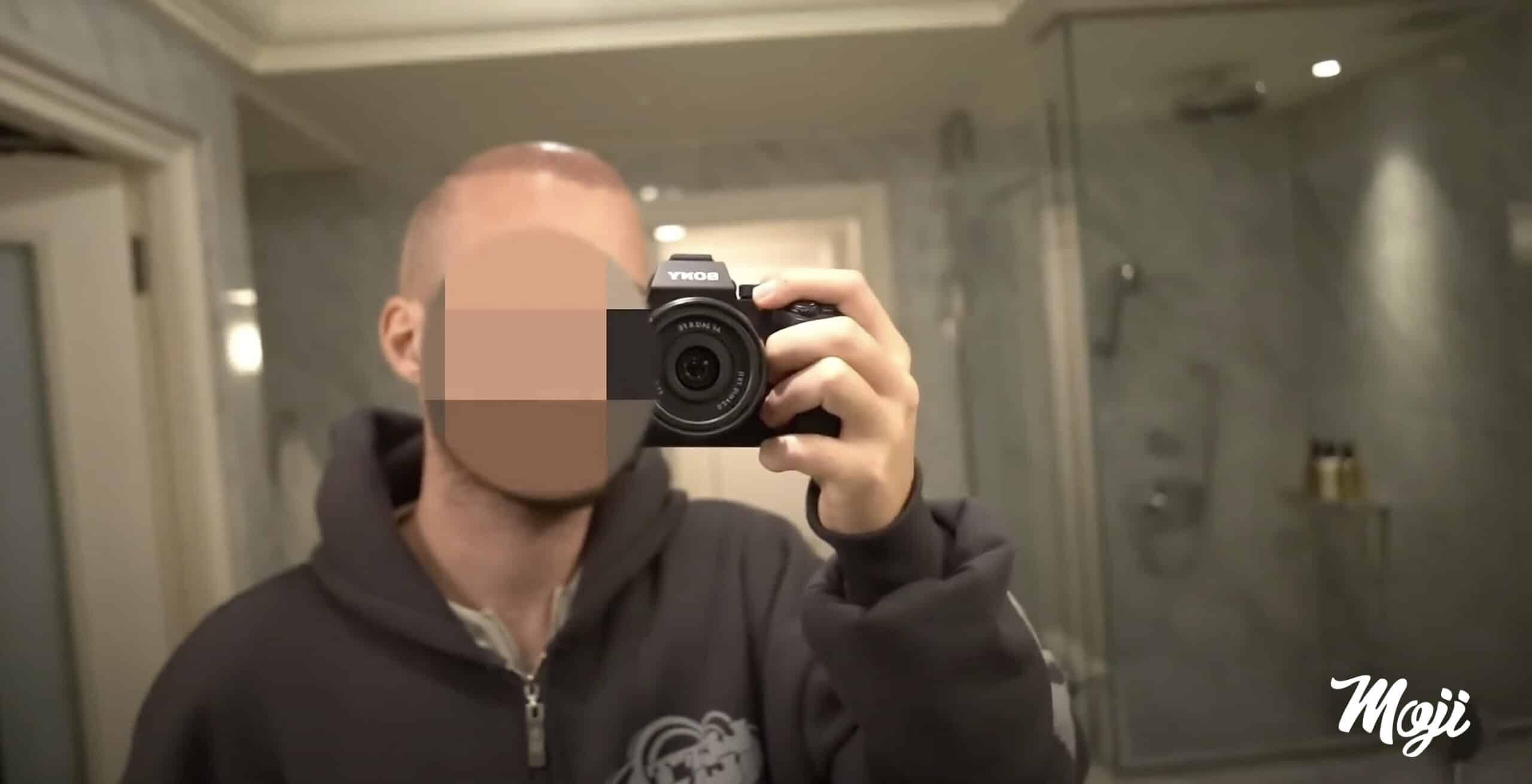 Mojis Gesicht: sein weg zur Haartransplantation